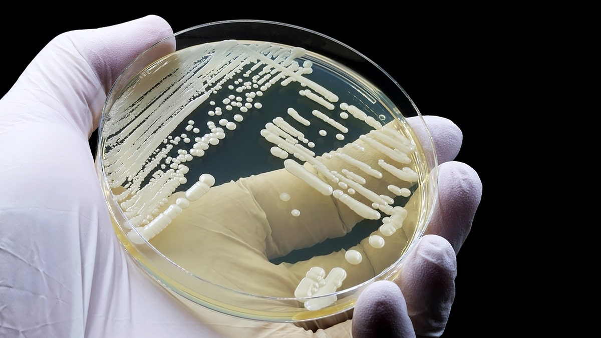 Dangerous fungus spreading in US hospitals has ‘rapidly increased'